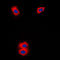 Cytochrome P450 Family 11 Subfamily A Member 1 antibody, GTX56293, GeneTex, Immunocytochemistry image 