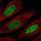 CCAAT Enhancer Binding Protein Delta antibody, NBP2-56564, Novus Biologicals, Immunofluorescence image 