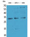 Synaptonemal complex protein 3 antibody, STJ96482, St John