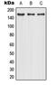 Mannose Receptor C-Type 1 antibody, MBS821427, MyBioSource, Western Blot image 