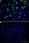 POU Class 3 Homeobox 2 antibody, ab94977, Abcam, Immunofluorescence image 