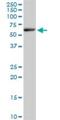 Elongator Acetyltransferase Complex Subunit 3 antibody, H00055140-B01P, Novus Biologicals, Western Blot image 