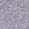 IKBKB Interacting Protein antibody, NBP2-58695, Novus Biologicals, Immunohistochemistry paraffin image 