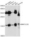 Microtubule Associated Protein 1 Light Chain 3 Gamma antibody, A8295, ABclonal Technology, Western Blot image 