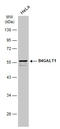 Beta-1,4-Galactosyltransferase 1 antibody, GTX131598, GeneTex, Western Blot image 