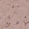 Sorcin antibody, NBP2-55404, Novus Biologicals, Immunohistochemistry paraffin image 