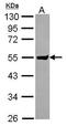 Clusterin Like 1 antibody, GTX115840, GeneTex, Western Blot image 