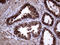 Anterior Gradient 2, Protein Disulphide Isomerase Family Member antibody, LS-C795128, Lifespan Biosciences, Immunohistochemistry paraffin image 