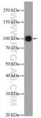 Plasminogen antibody, 26768-1-AP, Proteintech Group, Western Blot image 