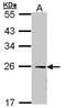 Eukaryotic Translation Initiation Factor 3 Subunit K antibody, PA5-27593, Invitrogen Antibodies, Western Blot image 