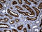 Angiotensin I Converting Enzyme 2 antibody, LS-C790043, Lifespan Biosciences, Immunohistochemistry paraffin image 