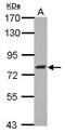 Glutamine-Fructose-6-Phosphate Transaminase 2 antibody, PA5-30340, Invitrogen Antibodies, Western Blot image 