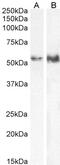 Transcription Factor EB antibody, 45-159, ProSci, Western Blot image 