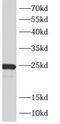 ADP Ribosylation Factor Like GTPase 4A antibody, FNab00577, FineTest, Western Blot image 