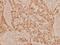 Mitogen-Activated Protein Kinase Kinase 3 antibody, A02916S183, Boster Biological Technology, Immunohistochemistry paraffin image 