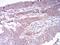 Histone Deacetylase 4 antibody, NBP2-52480, Novus Biologicals, Immunohistochemistry frozen image 