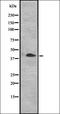 CD109 Molecule antibody, orb335121, Biorbyt, Western Blot image 