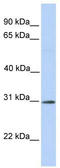 Ring Finger Protein 148 antibody, TA331532, Origene, Western Blot image 