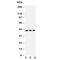 Death Associated Protein Kinase 2 antibody, R30635, NSJ Bioreagents, Western Blot image 