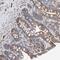Isoleucyl-TRNA Synthetase 2, Mitochondrial antibody, PA5-55118, Invitrogen Antibodies, Immunohistochemistry frozen image 