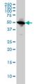 Tubulin Alpha 1c antibody, H00084790-M04, Novus Biologicals, Western Blot image 