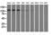 Transforming Acidic Coiled-Coil Containing Protein 3 antibody, GTX83531, GeneTex, Western Blot image 