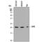 Dihydrofolate Reductase antibody, AF7934, R&D Systems, Western Blot image 