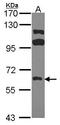 Fyn Related Src Family Tyrosine Kinase antibody, GTX107456, GeneTex, Western Blot image 