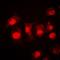 STAT3 antibody, orb214621, Biorbyt, Immunofluorescence image 