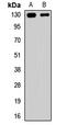 Calcium Voltage-Gated Channel Auxiliary Subunit Alpha2delta 4 antibody, LS-C668513, Lifespan Biosciences, Western Blot image 