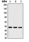 Thyroid Hormone Receptor Interactor 13 antibody, orb214887, Biorbyt, Western Blot image 
