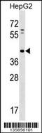 Phospholipid Phosphatase Related 5 antibody, 58-387, ProSci, Western Blot image 