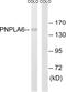 Neuropathy target esterase antibody, PA5-39304, Invitrogen Antibodies, Western Blot image 