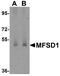 Major Facilitator Superfamily Domain Containing 1 antibody, A17695, Boster Biological Technology, Western Blot image 