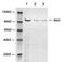 Protein Kinase D1 antibody, LS-B14103, Lifespan Biosciences, Western Blot image 