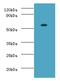 CD74 antibody, orb240960, Biorbyt, Western Blot image 