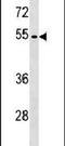 Glycogen Synthase Kinase 3 Alpha antibody, PA5-15400, Invitrogen Antibodies, Western Blot image 