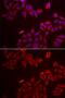 Galectin 8 antibody, GTX33214, GeneTex, Immunofluorescence image 