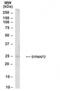 Synaptogyrin 2 antibody, NB100-1490, Novus Biologicals, Western Blot image 