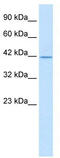 TFIIA-alpha and beta-like factor antibody, TA331190, Origene, Western Blot image 