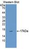 Calcitonin Receptor antibody, LS-C374474, Lifespan Biosciences, Western Blot image 