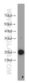 Coatomer Protein Complex Subunit Zeta 1 antibody, 20440-1-AP, Proteintech Group, Western Blot image 