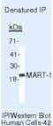 Melan-A antibody, MA5-14017, Invitrogen Antibodies, Immunoprecipitation image 