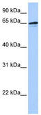 Zinc Finger Protein 417 antibody, TA341484, Origene, Western Blot image 