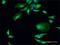 DGCR8 Microprocessor Complex Subunit antibody, H00054487-D01P, Novus Biologicals, Immunocytochemistry image 
