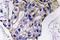 Interleukin 5 antibody, A01086S92, Boster Biological Technology, Immunohistochemistry paraffin image 