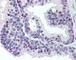 Chromodomain Helicase DNA Binding Protein 2 antibody, 49-278, ProSci, Immunohistochemistry frozen image 