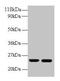 Retinol Binding Protein 4 antibody, CSB-PA07057A0Rb, Cusabio, Western Blot image 