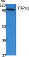 Transient Receptor Potential Cation Channel Subfamily V Member 3 antibody, STJ96460, St John