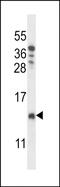 Cytochrome C Oxidase Assembly Factor 4 Homolog antibody, PA5-72018, Invitrogen Antibodies, Western Blot image 